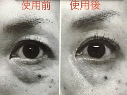 レッドパワーセラム効果